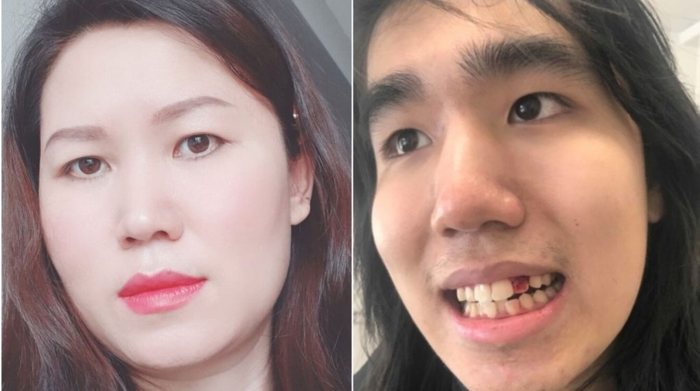 شاب يقتل أمه ويُقطّع أوصالها ويرميها في كيس قمامة