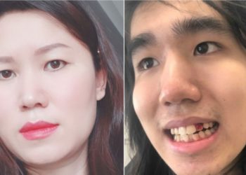 شاب يقتل أمه ويُقطّع أوصالها ويرميها في كيس قمامة