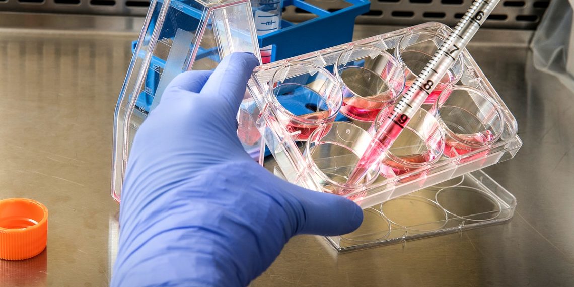 تأكيد 5 حالات إصابة بجدري القرود في كيبيك