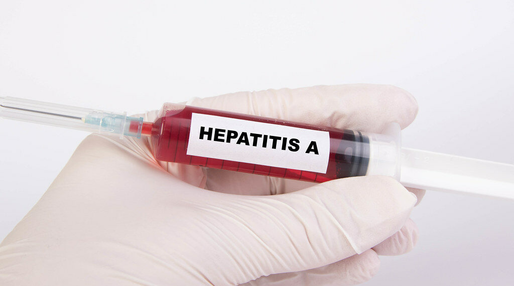 الصحة العامة تُحذّر من التعرض المحتمل لالتهاب الكبد A في أحد أفران  Ahuntsic-Cartierville