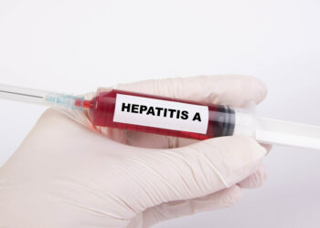 الصحة العامة تُحذّر من التعرض المحتمل لالتهاب الكبد A في أحد أفران  Ahuntsic-Cartierville