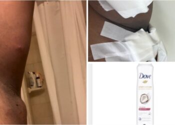 تحذيرات من استعمال مزيل العرق من ماركة “Dove”