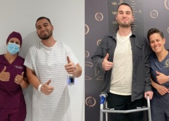 هذا ما يقوم به المكان الوحيد في كندا لتطويل الأطراف في مونتريال