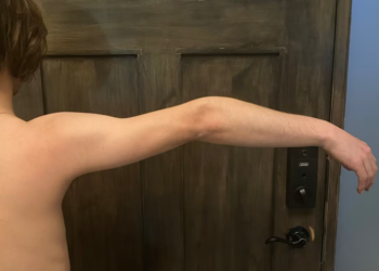 إذا كنت تريد مقاضاة طبيب في كندا على خطأ طبي ارتكبه فهذا ما ستواجهه