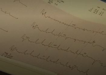 نقص دواء القلب dipyridamole في كندا سيؤدي إلى انتظار المرضى لفترة أطول