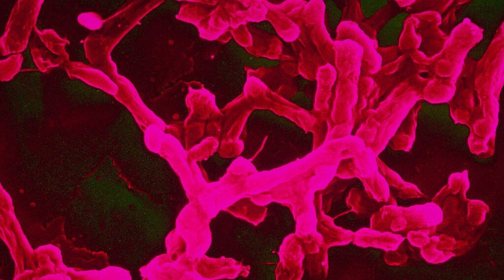 ما هي بكتيريا الميكوبلازما/Mycoplasma المسؤولة عن الزيادة الأخيرة في حالات الالتهاب الرئوي في الولايات المتحدة
