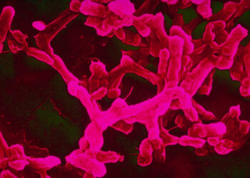 ما هي بكتيريا الميكوبلازما/Mycoplasma المسؤولة عن الزيادة الأخيرة في حالات الالتهاب الرئوي في الولايات المتحدة