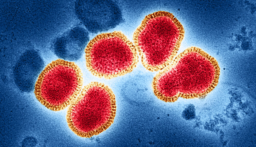 اكتشاف سلالات أنفلونزا مقاومة للأدوية في الولايات المتحدة