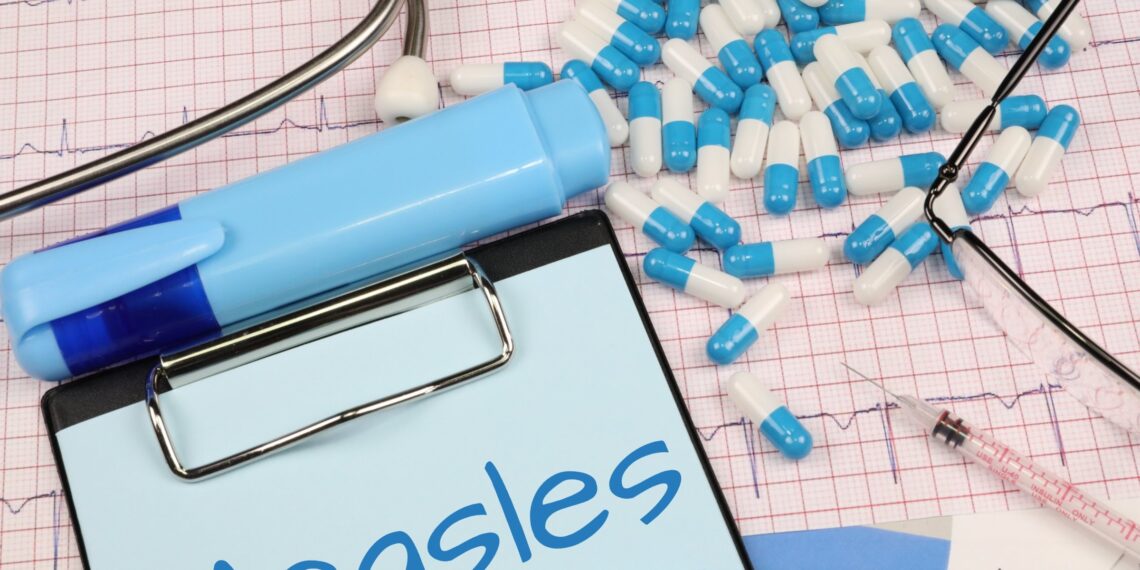 تأكيد الإصابة السادسة بالحصبة في ميشيغان لدى طفل في مقاطعة Macomb