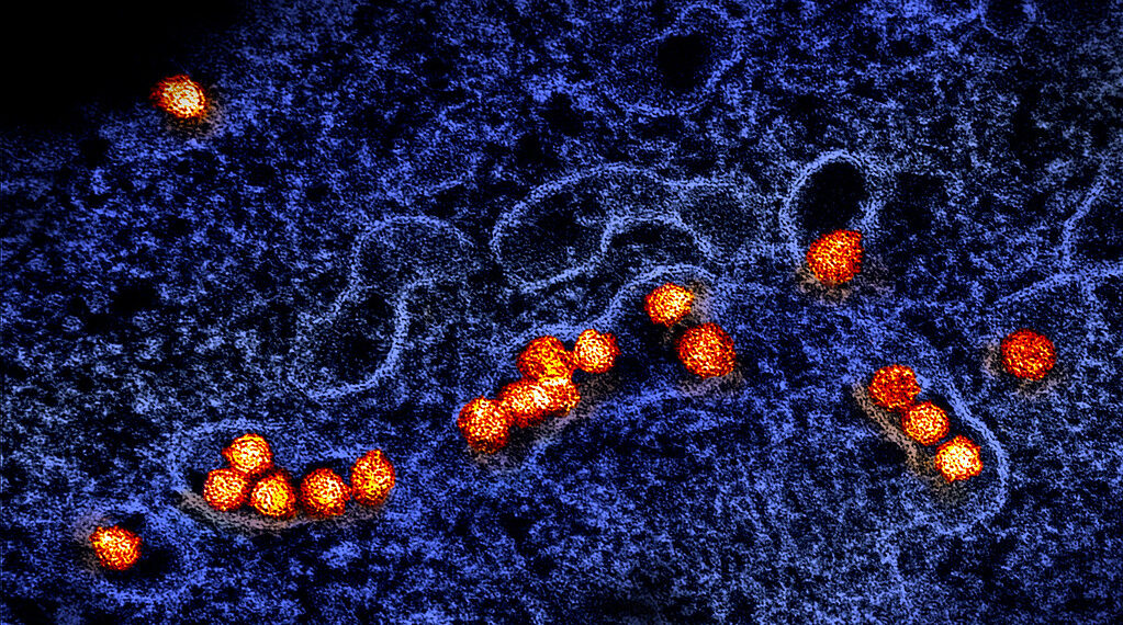 وزارة الصحة تُعلن اكتشاف فيروس “West Nile/غرب النيل” في مقاطعة Monroe