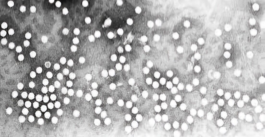 مركز السيطرة على الأمراض والوقاية منها (CDC) يُحذّر من انتشار فيروس تنفسي شديد العدوى بين الأطفال